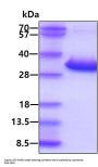 Human 17 beta -HSD14/HSD17B14 Recombinant Protein