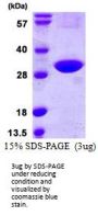 Human CINP Recombinant Protein