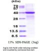 Human PINK1 Recombinant Protein