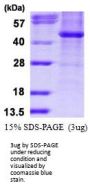 Human Histone Deacetylase 8 Recombinant Protein