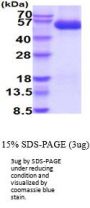 Human Nogo Receptor Recombinant Protein