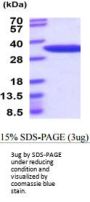 Mouse Nmnat1 Recombinant Protein