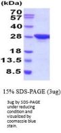 Mouse MESDC2 Recombinant Protein