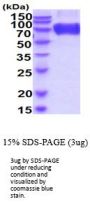 Mouse CD200 R1 Recombinant Protein