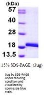 Human MAP1LC3B Recombinant Protein