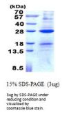 Human AICDA Recombinant Protein