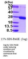 Human RAB1B Recombinant Protein