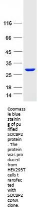 Syntenin 2 (SDCBP2) (NM_015685) Human Recombinant Protein