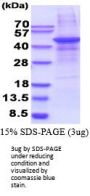 Human MMP28 Recombinant Protein