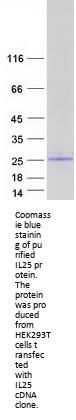 IL17E (IL25) (NM_172314) Human Recombinant Protein