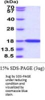 Human LC3A/MAP1LC3A Recombinant Protein