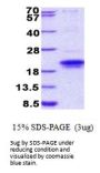 Human IGFLR1 Recombinant Protein