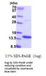 Human AA Recombinant Protein