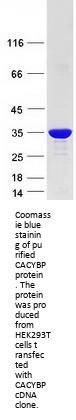 SIAH Interacting Protein (CACYBP) (NM_014412) Human Recombinant Protein