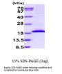 Human IL-21 Recombinant Protein