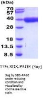 Human IL-21 R Recombinant Protein