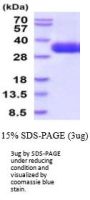 Human TSLP R Recombinant Protein