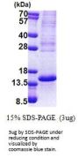 Human TP53AIP1 Recombinant Protein