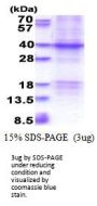Human XRCC2 Recombinant Protein