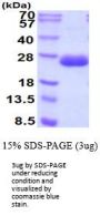 Mouse FGF-21 Recombinant Protein