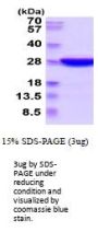 Mouse Uchl3 Recombinant Protein