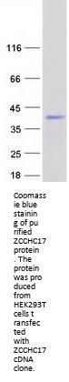ZCCHC17 (NM_016505) Human Recombinant Protein