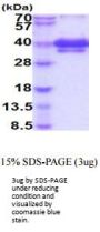 Human TWEAK R/TNFRSF12 Recombinant Protein