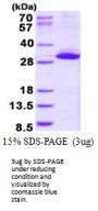 Human ITGB1BP3 Recombinant Protein