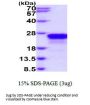 Human Endocan Recombinant Protein