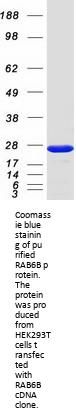 RAB6B (NM_016577) Human Recombinant Protein