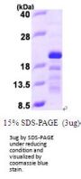 Human Stathmin-3/STMN3 Recombinant Protein
