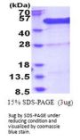 Human BCCIP Recombinant Protein