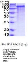 Mouse TLR2 Recombinant Protein
