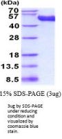 Mouse CD5L Recombinant Protein