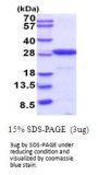Mouse UCH-L1 Recombinant Protein