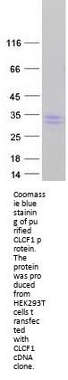 NNT1 (CLCF1) (NM_013246) Human Recombinant Protein