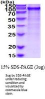 Human UBA2 Recombinant Protein