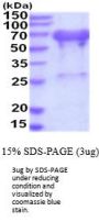 Human UBQLN2 Recombinant Protein