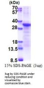 Human PCSK1N Recombinant Protein