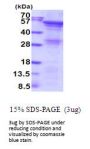 Human Angiopoietin-like 2 Recombinant Protein