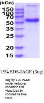 Human Frizzled-4 Recombinant Protein