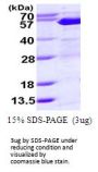 Human SUFU Recombinant Protein