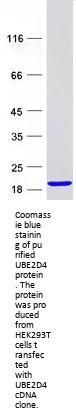 UBE2D4 (NM_015983) Human Recombinant Protein