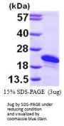 Human ARL2BP Recombinant Protein