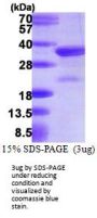Human VPS24 Recombinant Protein
