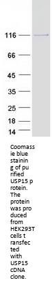 USP15 (NM_006313) Human Recombinant Protein