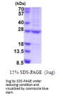 Human N6AMT1 Recombinant Protein