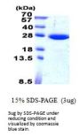 Human SAR1B Recombinant Protein