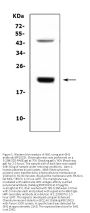 Anti-Growth Hormone/GH1 Antibody Picoband®