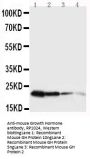 Anti-Growth Hormone/GH1 Antibody Picoband®